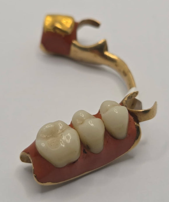 Teeth Set in Gold
