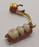 Teeth Set in Gold