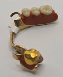 Teeth Set in Gold